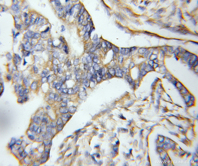 GPSM2 Antibody in Immunohistochemistry (Paraffin) (IHC (P))