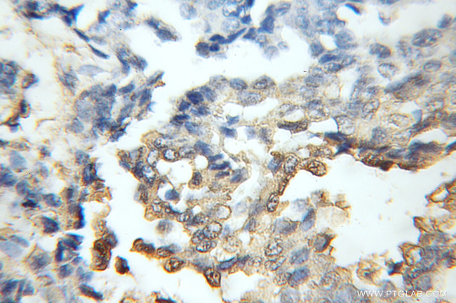 CDR2 Antibody in Immunohistochemistry (Paraffin) (IHC (P))