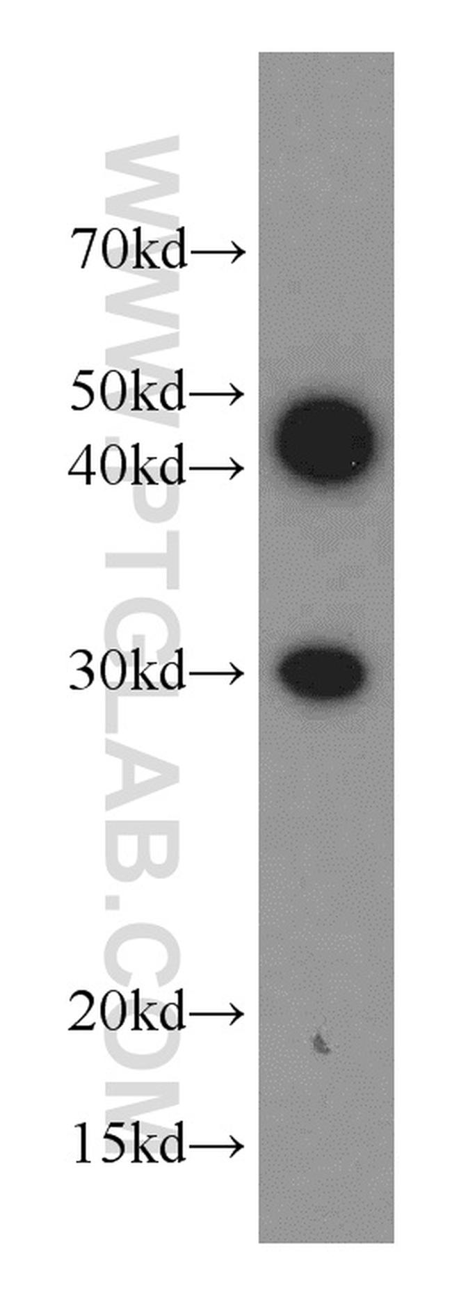 RAB20 Antibody in Western Blot (WB)