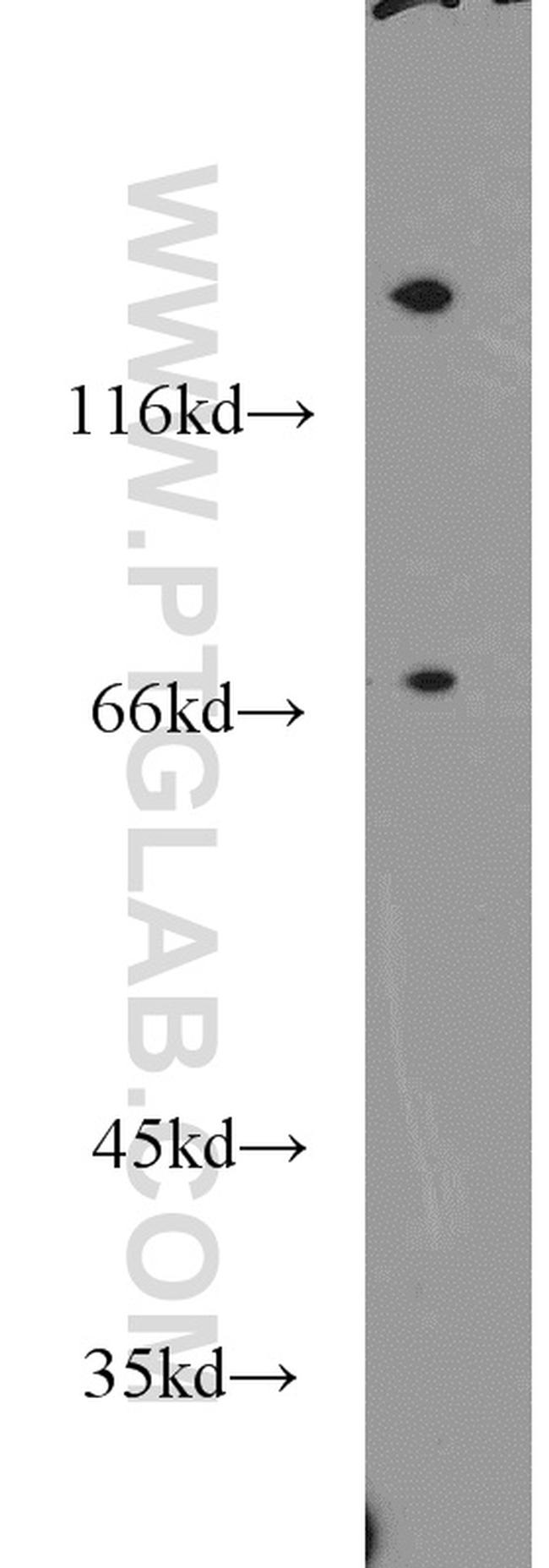 NEIL3 Antibody in Western Blot (WB)