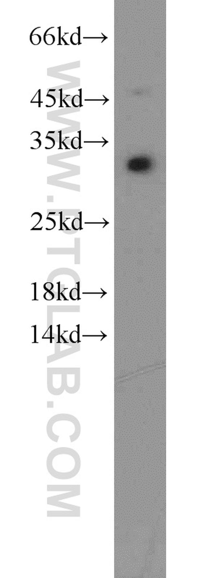 CDCA4 Antibody in Western Blot (WB)