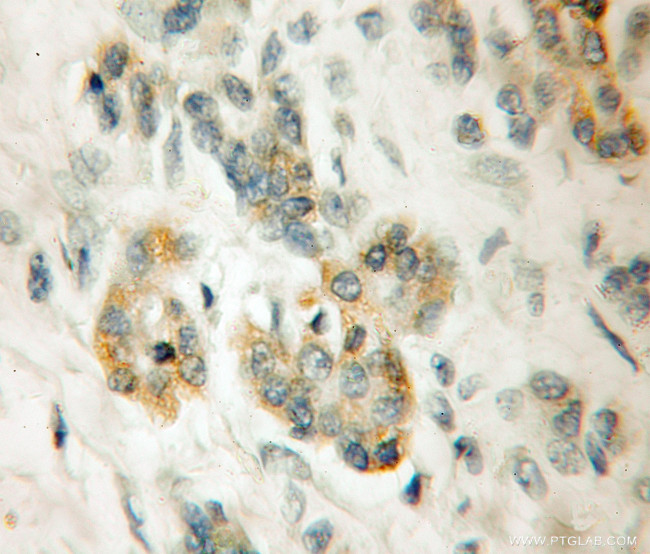 LRR 1 Antibody in Immunohistochemistry (Paraffin) (IHC (P))