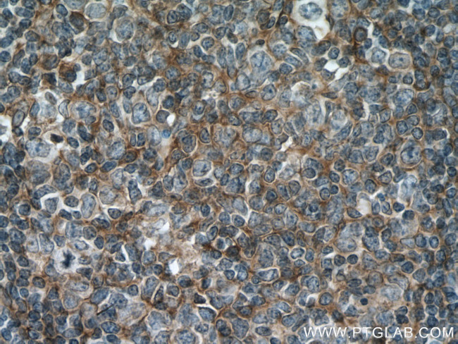 Podoplanin Antibody in Immunohistochemistry (Paraffin) (IHC (P))