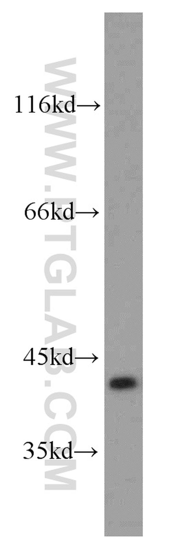 SLC22A18 Antibody in Western Blot (WB)