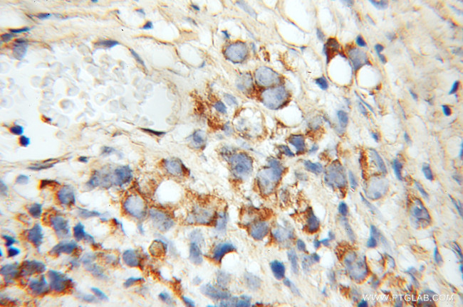 RRAS Antibody in Immunohistochemistry (Paraffin) (IHC (P))