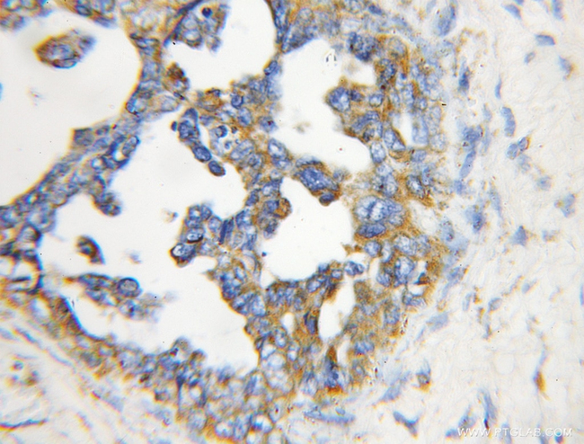 EPHA2 Antibody in Immunohistochemistry (Paraffin) (IHC (P))