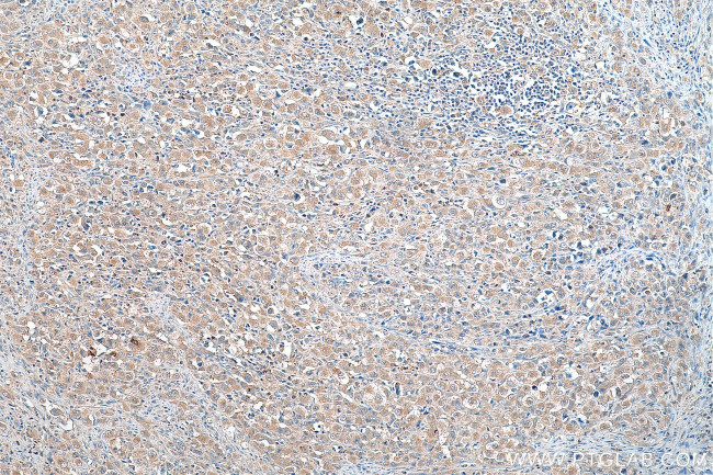 AP4M1 Antibody in Immunohistochemistry (Paraffin) (IHC (P))