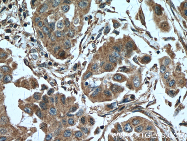 HHIP Antibody in Immunohistochemistry (Paraffin) (IHC (P))