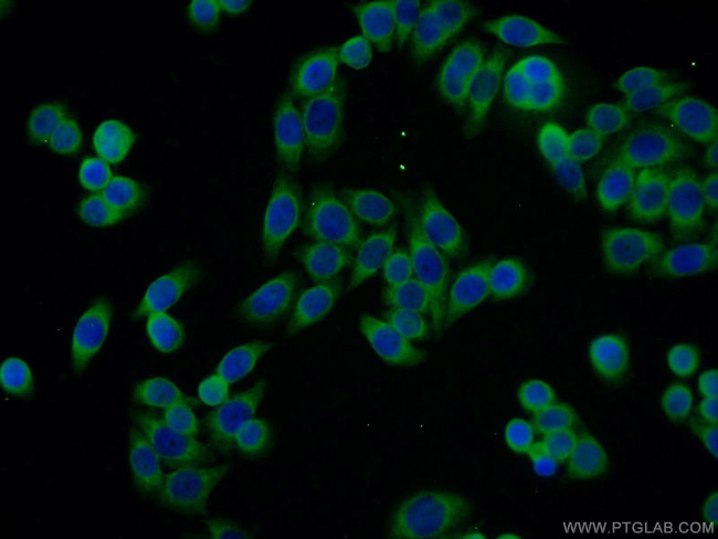 SSR4 Antibody in Immunocytochemistry (ICC/IF)