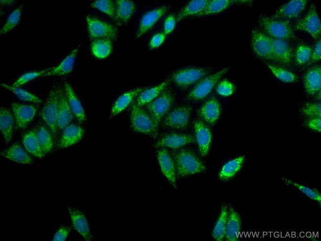 WSB1 Antibody in Immunocytochemistry (ICC/IF)