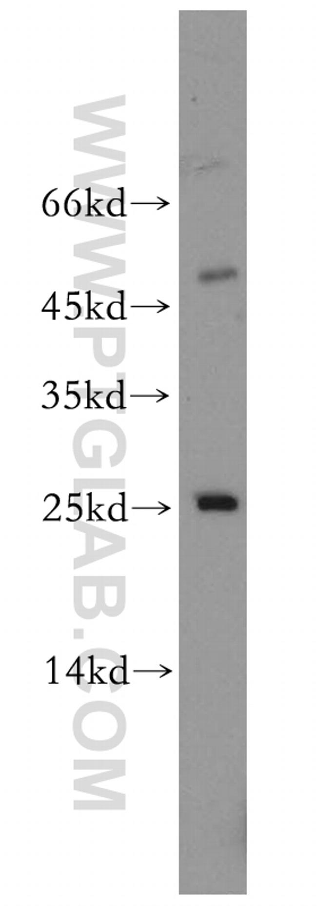 MOBKL1B Antibody in Western Blot (WB)