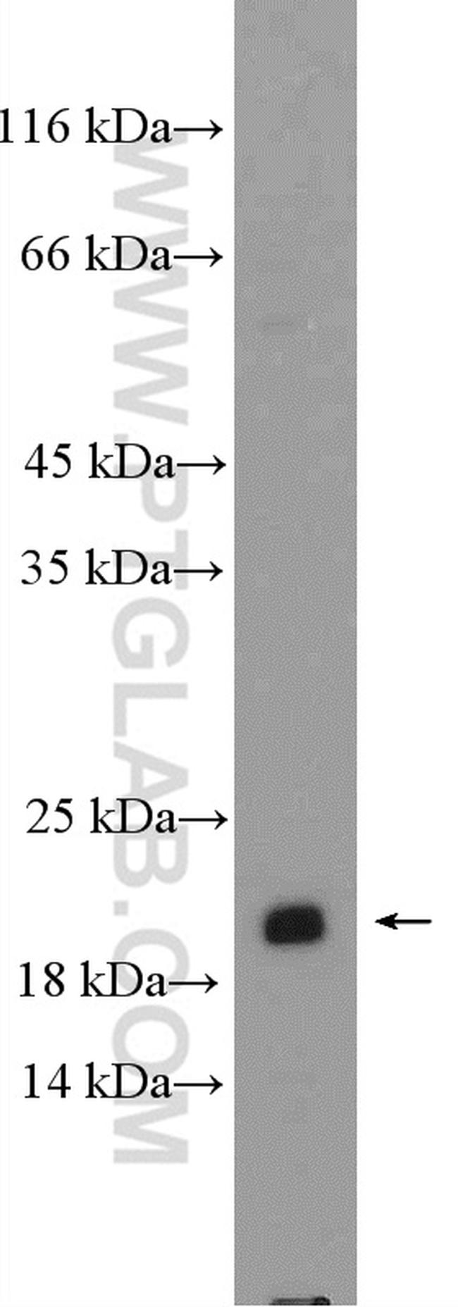 SSX1 Antibody in Western Blot (WB)