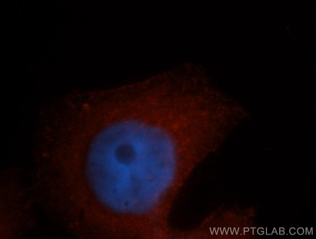 PDLIM1/CLP36 Antibody in Immunocytochemistry (ICC/IF)
