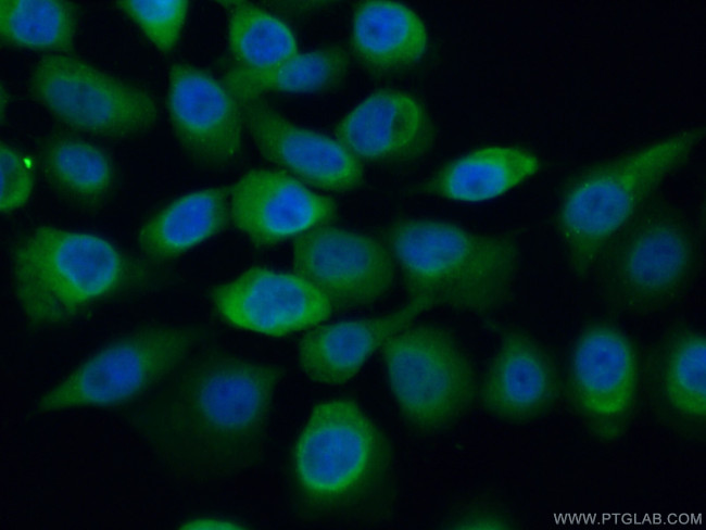 SUGT1 Antibody in Immunocytochemistry (ICC/IF)