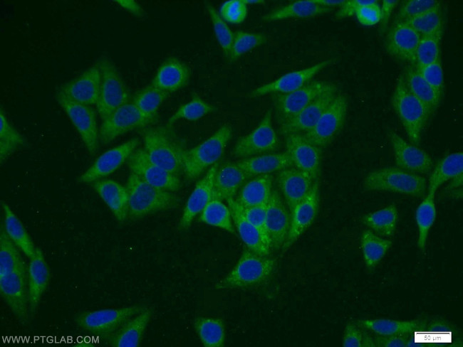 TTC1 Antibody in Immunocytochemistry (ICC/IF)