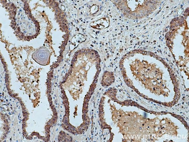 UBE2D3 Antibody in Immunohistochemistry (Paraffin) (IHC (P))