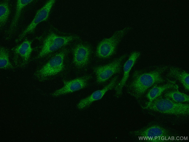 Ferritin heavy chain Antibody in Immunocytochemistry (ICC/IF)