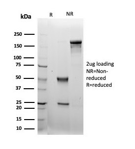 LRG1/Leucine Rich alpha-2-glycoprotein 1 Antibody in SDS-PAGE (SDS-PAGE)