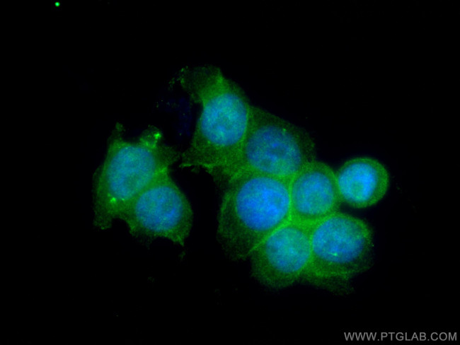 PLEK2 Antibody in Immunocytochemistry (ICC/IF)