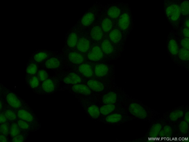 HMGN4 Antibody in Immunocytochemistry (ICC/IF)