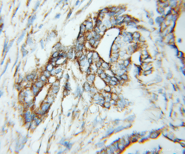 TPST2 Antibody in Immunohistochemistry (Paraffin) (IHC (P))
