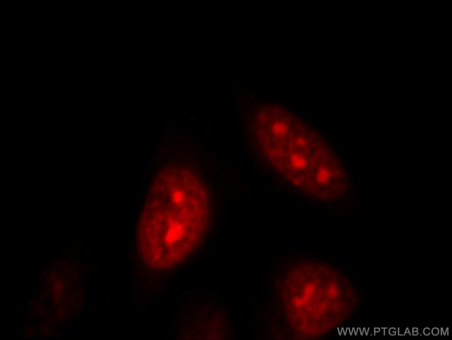DNAJB6 Antibody in Immunocytochemistry (ICC/IF)