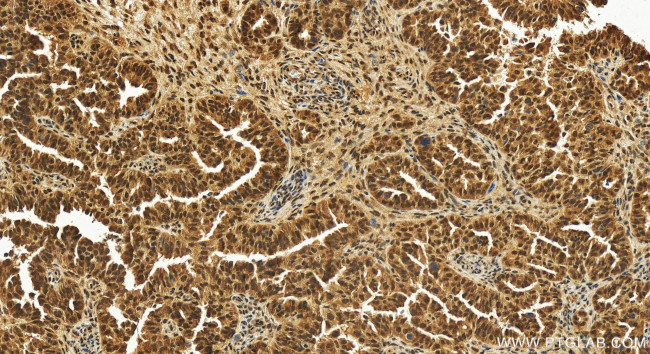 THOC3 Antibody in Immunohistochemistry (Paraffin) (IHC (P))
