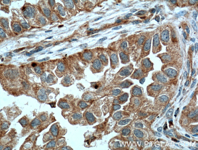 RHOD Antibody in Immunohistochemistry (Paraffin) (IHC (P))