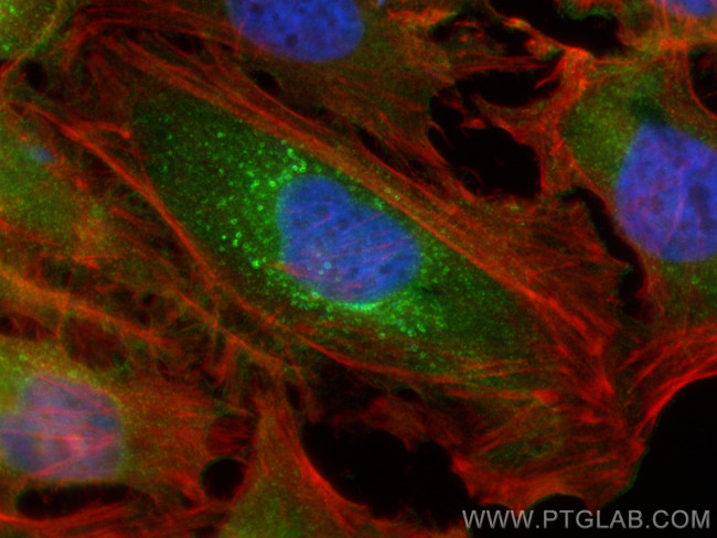 RAB13 Antibody in Immunocytochemistry (ICC/IF)