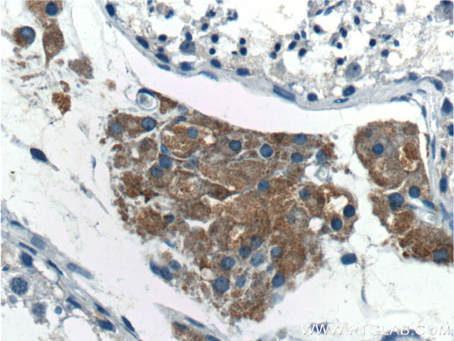 SPOCK2 Antibody in Immunohistochemistry (Paraffin) (IHC (P))