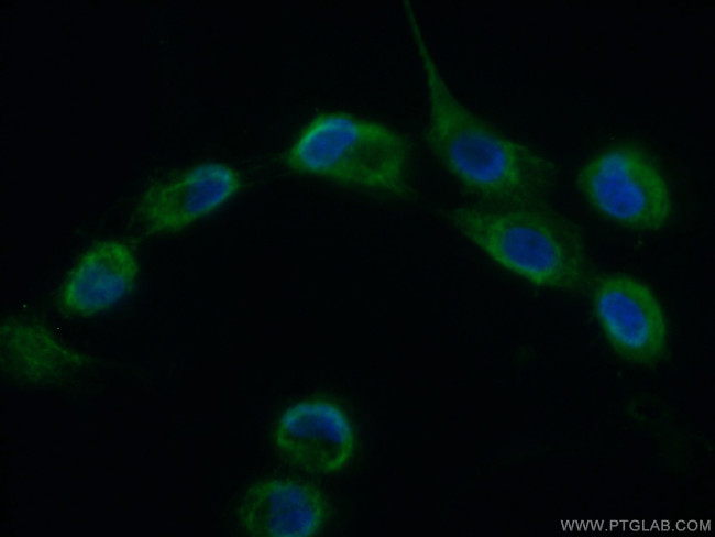 CHCHD1 Antibody in Immunocytochemistry (ICC/IF)