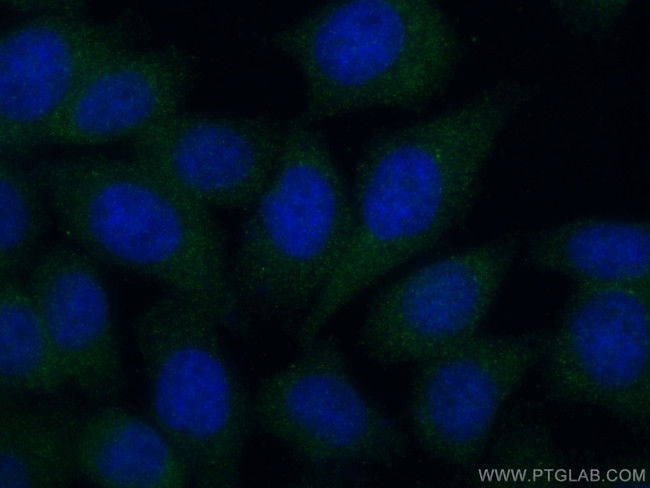 ASB8 Antibody in Immunocytochemistry (ICC/IF)