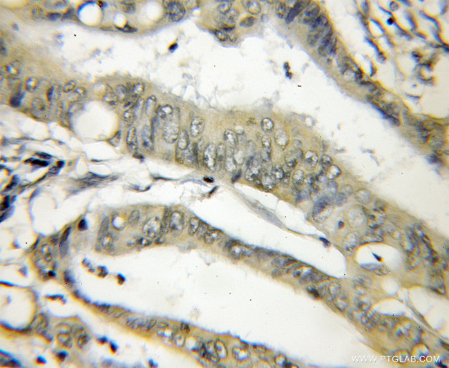 THOP1 Antibody in Immunohistochemistry (Paraffin) (IHC (P))