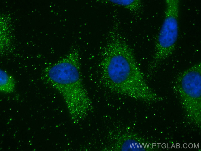 PKIA Antibody in Immunocytochemistry (ICC/IF)