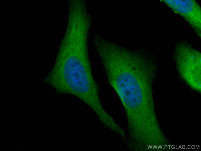 CACYBP Antibody in Immunocytochemistry (ICC/IF)