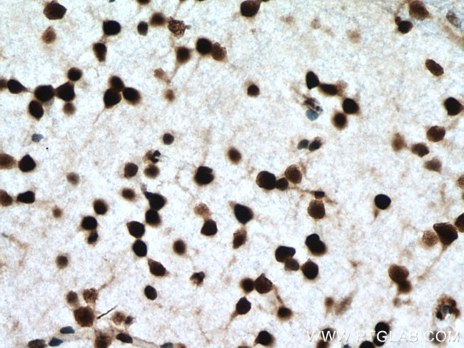 NFIA Antibody in Immunohistochemistry (Paraffin) (IHC (P))
