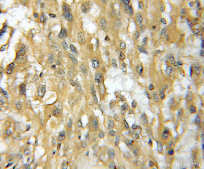 TMOD4 Antibody in Immunohistochemistry (Paraffin) (IHC (P))