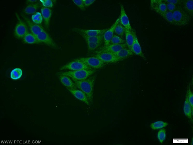 ZNF395 Antibody in Immunocytochemistry (ICC/IF)