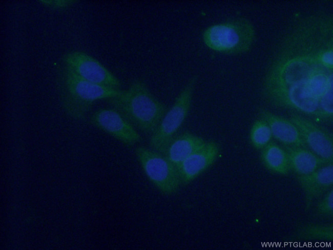 NUDCD3 Antibody in Immunocytochemistry (ICC/IF)
