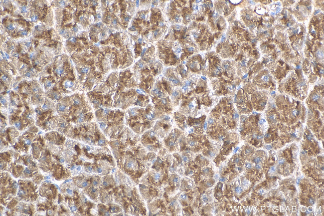 CLPS Antibody in Immunohistochemistry (Paraffin) (IHC (P))