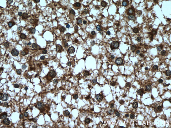 SEPT8 Antibody in Immunohistochemistry (Paraffin) (IHC (P))