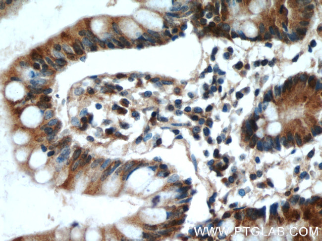 ITLN1 Antibody in Immunohistochemistry (Paraffin) (IHC (P))