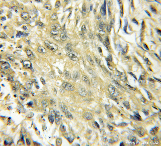 CYP4B1 Antibody in Immunohistochemistry (Paraffin) (IHC (P))