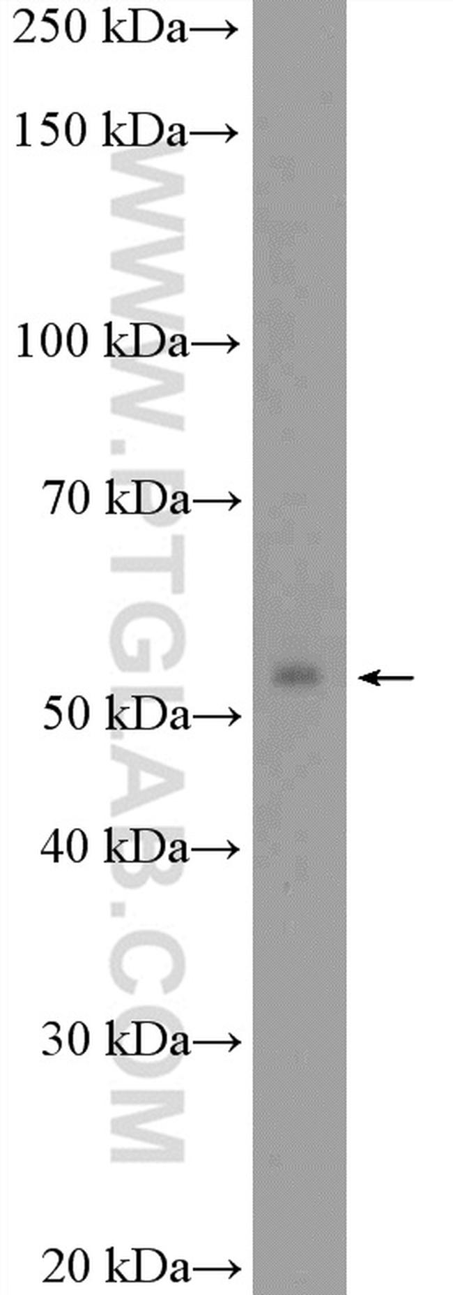 SFRS6 Antibody in Western Blot (WB)