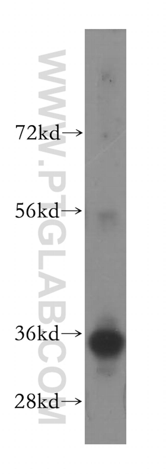 FCN1 Antibody in Western Blot (WB)