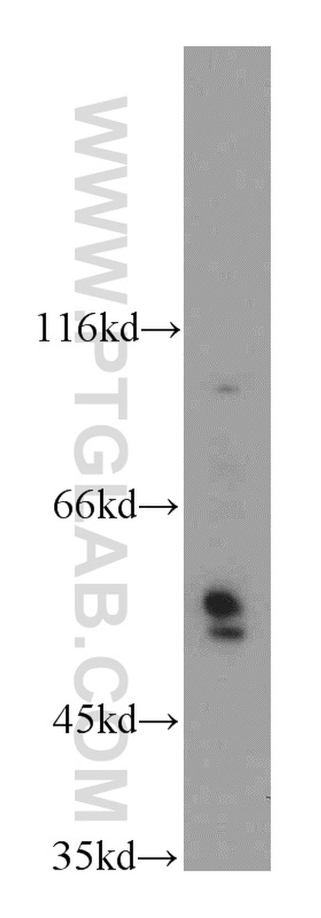 CXADR Antibody in Western Blot (WB)