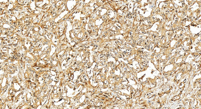FAPA Antibody in Immunohistochemistry (Paraffin) (IHC (P))