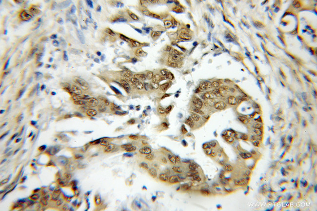 TRAF7 Antibody in Immunohistochemistry (Paraffin) (IHC (P))
