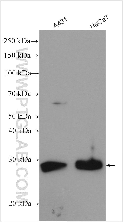 MPZL2 Antibody in Western Blot (WB)