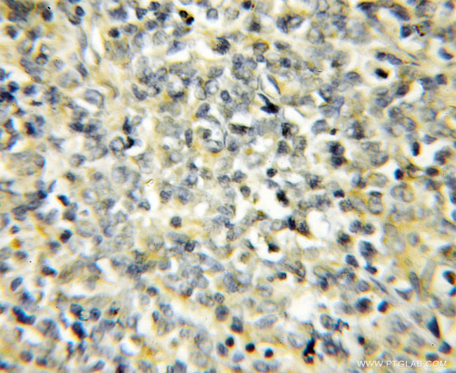 NIPSNAP3B Antibody in Immunohistochemistry (Paraffin) (IHC (P))